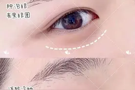 双眼皮越宽越有神？如何正确理解双眼皮图片