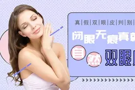 切开双眼皮能维持多久？效果是永久的吗？图片