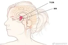 垂体瘤：听着很可怕，到底是个啥？图片