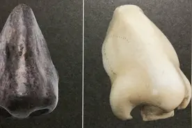 性病梅毒为啥能横扫世界？考古学家用骨头给你答案图片