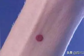 守宫砂如何制作？一点红就能辨女子清白吗图片