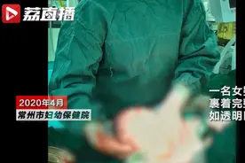 “哪吒”降世？女婴出生如透明巨蛋，医生：胎膜护体图片