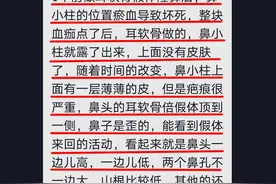 6年整形失败？鼻子、太阳穴、眉骨、嘴唇、下巴，问题出在哪？图片