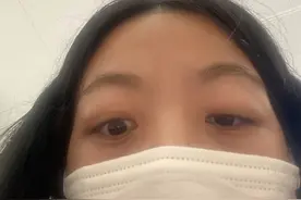 甲亢以痛吻我，我却报之以歌图片