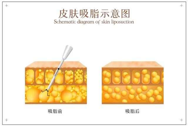 面部年轻化的最好方法 2026年面部年轻化的最好方法吃什么最快恢复