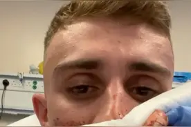 跆拳道国家队员街头遇袭，被一拳打的血肉模糊必须整容图片