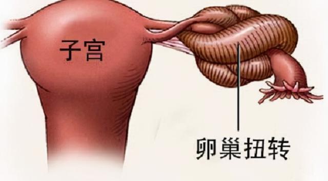 取卵后喝板栗花胶乌鸡汤吗 取卵后喝板栗花胶乌鸡汤吗有影响吗