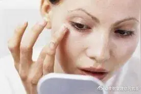 医美治疗的是与非之二——治疗后反黑是怎么回事?图片