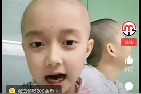 患白血病光头女孩提醒大家不要吃辣条图片