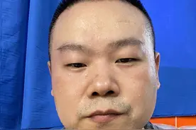 36岁的岳云鹏晒自拍照，满脸汗水想要减肥，网友还帮他瘦脸了图片