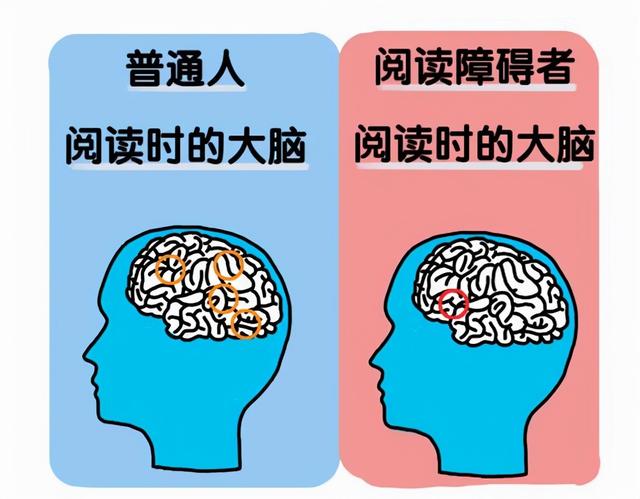 是智力有问题?揭开学渣噩梦的真实原因