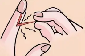 手上有倒刺怎么办？暴力撕扯有错吗？其实预防比较重要图片