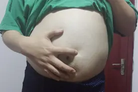 “5+2”轻断食，或能给您新的减肥思路，大家可做参考图片