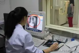 为何女孩都害怕做“胸透”呢？医生都能看到什么？不妨了解一下图片