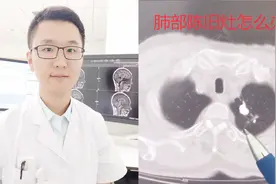 肺部CT检查发现肺部条索灶，陈旧灶究竟是什么？视频封面
