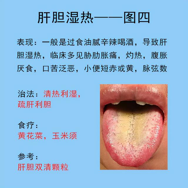 肝阴虚的主要表现症状以及主要用药,一文读懂,请详看(肝肾阴虚的症状