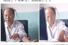 挂了个专家号打算治脱发，看到医生懵了，这头发是刚长出来的吗？图片
