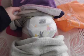 “快看，妹妹流血了”，面对纸尿裤变色，哥哥的反应连医生都点赞图片