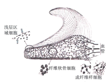 老人关节炎或者半月板不好，吃氨基葡萄糖或者软骨素有用吗？