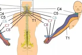 不同部位的手麻、胳膊疼，是哪个节段的颈椎出了问题？图片