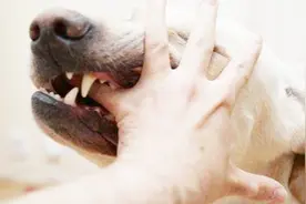 为什么狂犬病患者发作时会怕水？原因有这三点，看完可要记住了