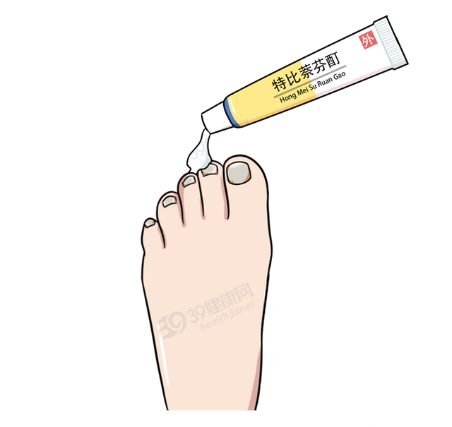得了灰指甲，反复发作难根治？一次性介绍7种药，总有一款适合你