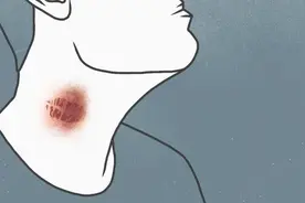“种草莓”虽然不太可能感染艾滋病，但依然有生命危险图片