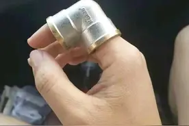 不小心把手指头伸进去了，拿不出来，现在该怎么办呀图片