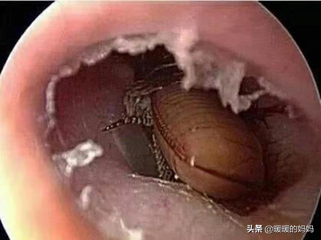 被别人摸耳朵鸡皮疙瘩