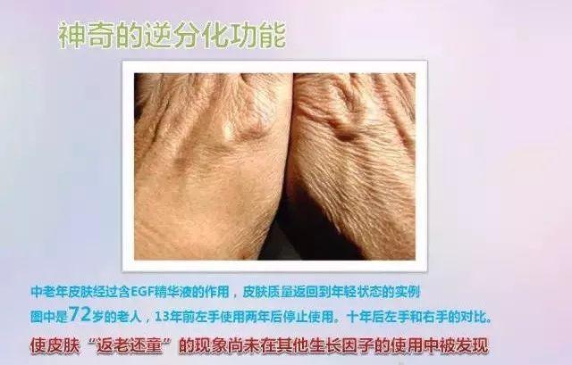 美肌冻干粉有什么作用 美肌冻干粉有什么作用和功效