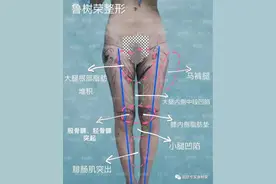 直腿术的加减法视错觉图片