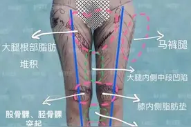 直腿术的加减法视错觉图片