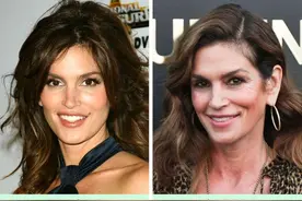 15位好莱坞明星在整容前后的对比照片图片