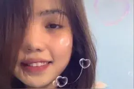 被泼硫酸毁容女也有春天，越南大美女脸部修复重拾自信，坚强生活图片