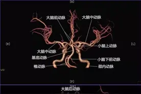 颅内MRA解剖及其分段图片