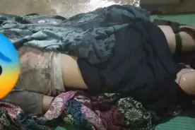 缅甸17岁花季少女踩到地雷，双腿被炸断图片