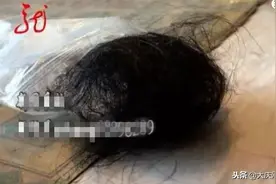 宾县男子买了瓶美涛水润保湿啫喱水，用后竟然大量掉头发！图片