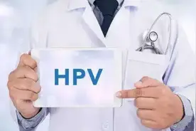 宫颈TCT检查知多少？图片