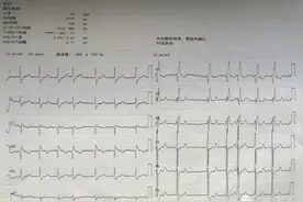 心房颤动？完全性右束支阻滞？心肌病？图片
