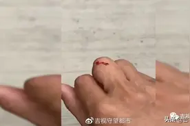 求锤得锤！动植物公园里被蛇咬伤，园方“求实锤”，热心游客提供录像图片