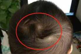 老人说：头旋和智商有关，头旋越多的宝宝，智商也会更高吗？图片