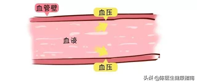 降压药什么时候吃最好，早上还是晚上？听听医生怎么说