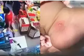 下手真狠！厦门“容嬷嬷”逛超市，掐掉婴儿一块皮！已被拘留图片