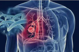 22岁少女罹患肺癌，19次放化疗，两次濒临死亡，她成功走过来了图片