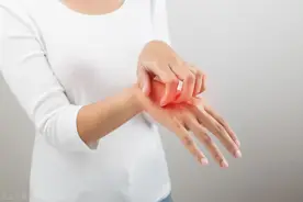 皮肤瘙痒怎么办？这4个外用止痒药膏建议家中常备图片