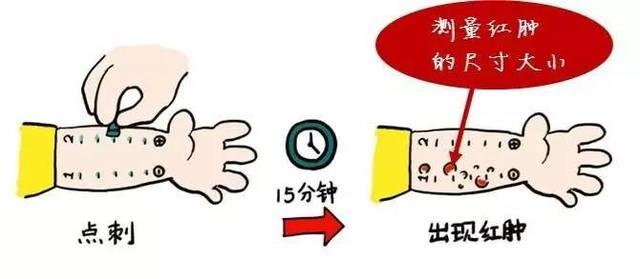 特配粉怎么选？它是宝宝生病时的营养餐，这些适应症妈妈要记住