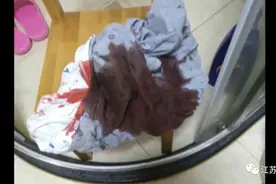 8岁男童半夜血染床单，竟是体内这东西掉了下来！图片