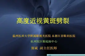 高度近视黄斑劈裂图片