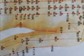 双膝痛疼屈伸不利的治疗验案，立显效果，值得一看！图片