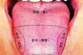 再谈舌诊的分析图片